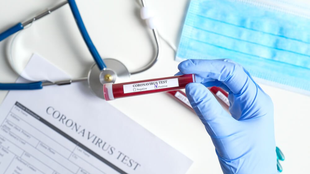 Coronavirus blood test concept.